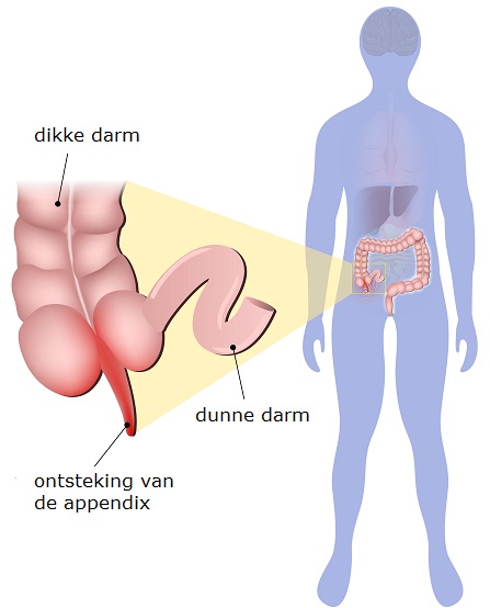 wat doet je blinde darm wat doet je blinde darm